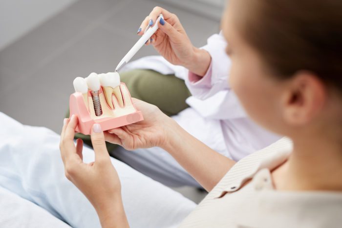 Dental Implants in Akron, Pennsylvania