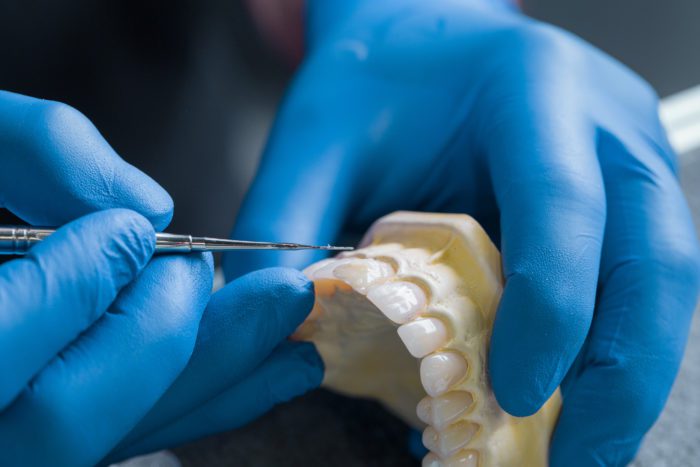 Restorative Dentistry in Akron, Pennsylvania