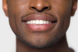 dental implants in Akron, PA