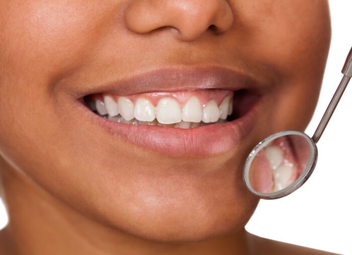 Gum disease in Akron, PA, affects more than just your smile.